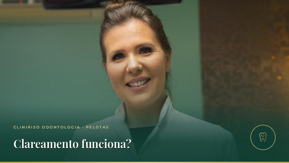 Clareamento dental: o que funciona e o que é mito — Cliniriso, Pelotas